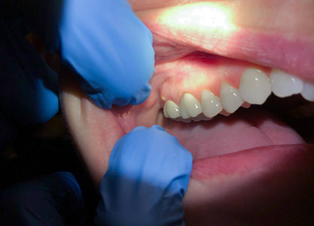 Best Same-Day Emergency Dentist in Commerce, TX